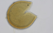 SAF122 Diversispora epigaea